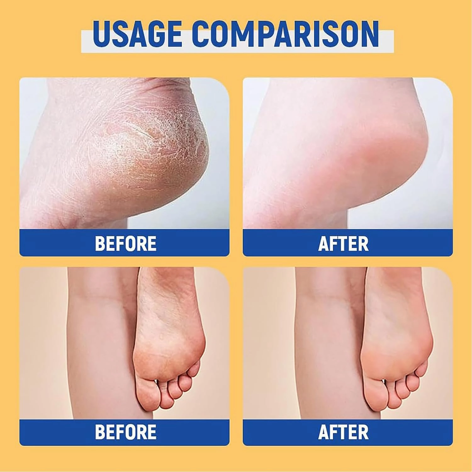 Urea Foot Cream, Cracked Heel Repair Cream, Urea Foot Cream 60 Percent, Heel Balm, Petroleum Jelly, FootCream For Cracked Heels And Dry Skin, Dry Feet Calluses And Hard Skin (3 pcs)